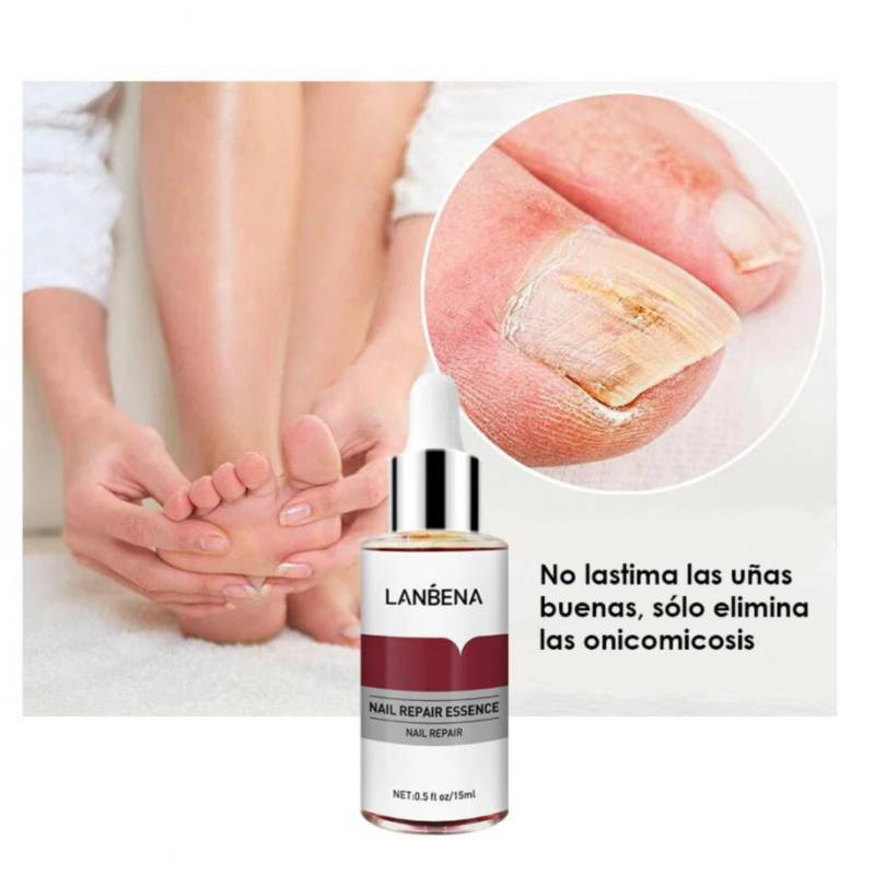 Gel Anti hongos en la uña - Lambena 15ml